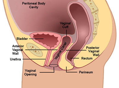 vaginal cuff post hysterectomy